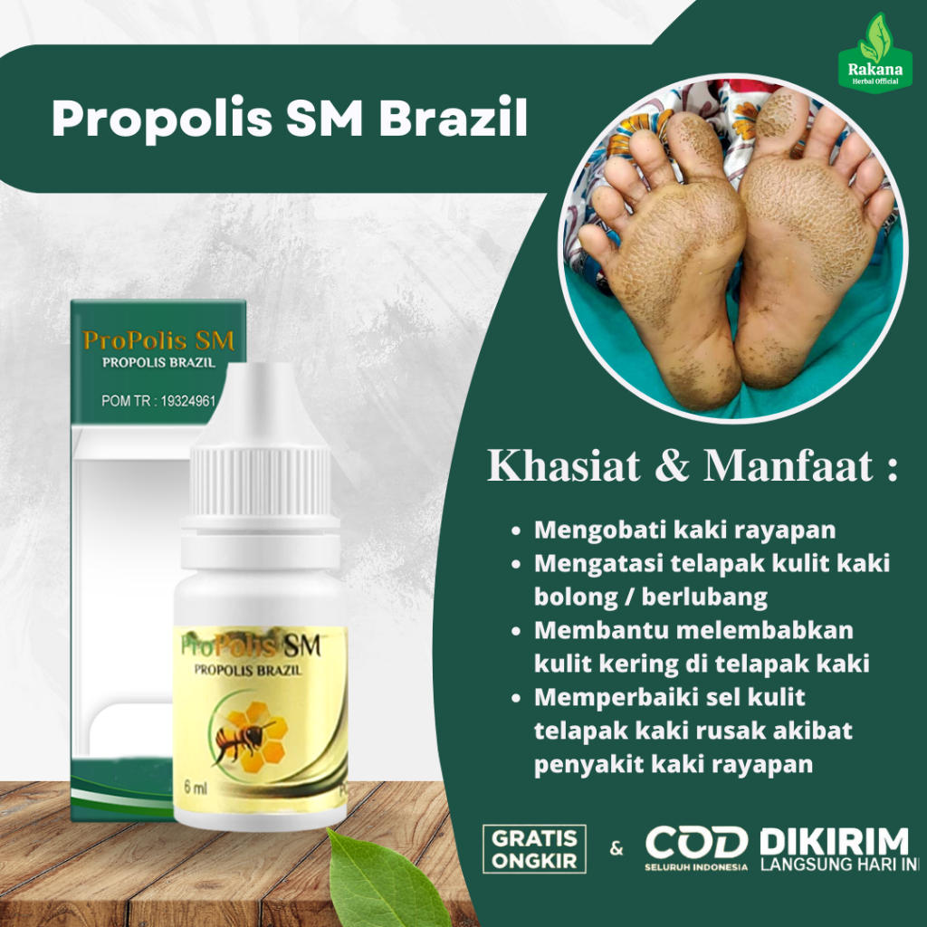 Obat Kaki Rayapan Berbau, Obat Telapak Kaki Rayapan, Obat Telapak Kaki Bolong, Obat Telapak Kaki Ber