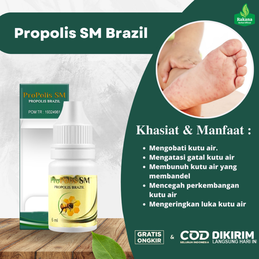 Obat Kutu Air Herbal, Kutu Air Di Sela Jari, Kutu Air Di Tangan, Kutu Air Di Kaki | Propolis SM
