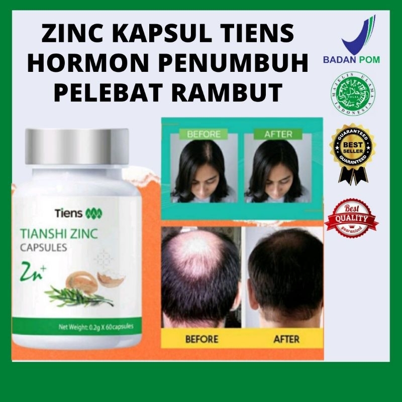 Tianshi Tiens Zinc Kapsul Hornon Penumbuh Melebatkan Rambut | Meperkuat Akar Rambut