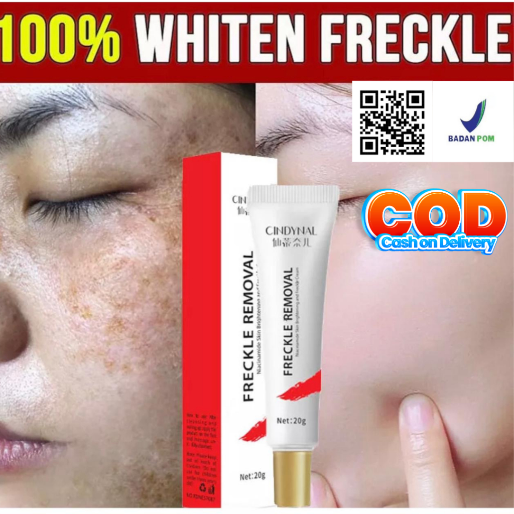 Cindynal Niacimide Skin Cream 20gr Salep Flek Hitam Membandel Diwajah Ampuh Dan Efektif Untuk Bekas 