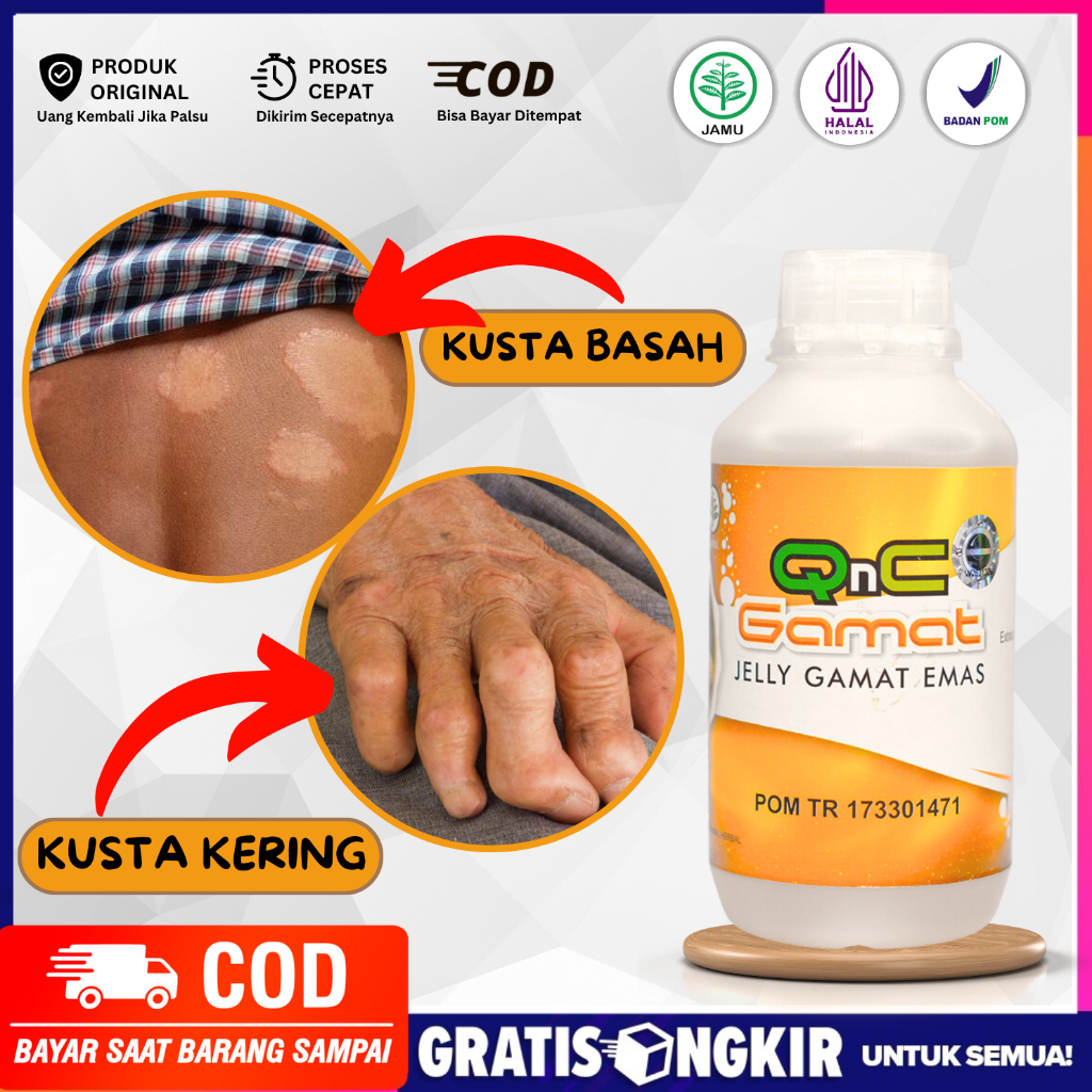 Obat Kusta - Lepra - Kusta Kering - Kusta Basah - Obat Penyakit Kulit - Qnc Jelly Gamat Asli 100%
