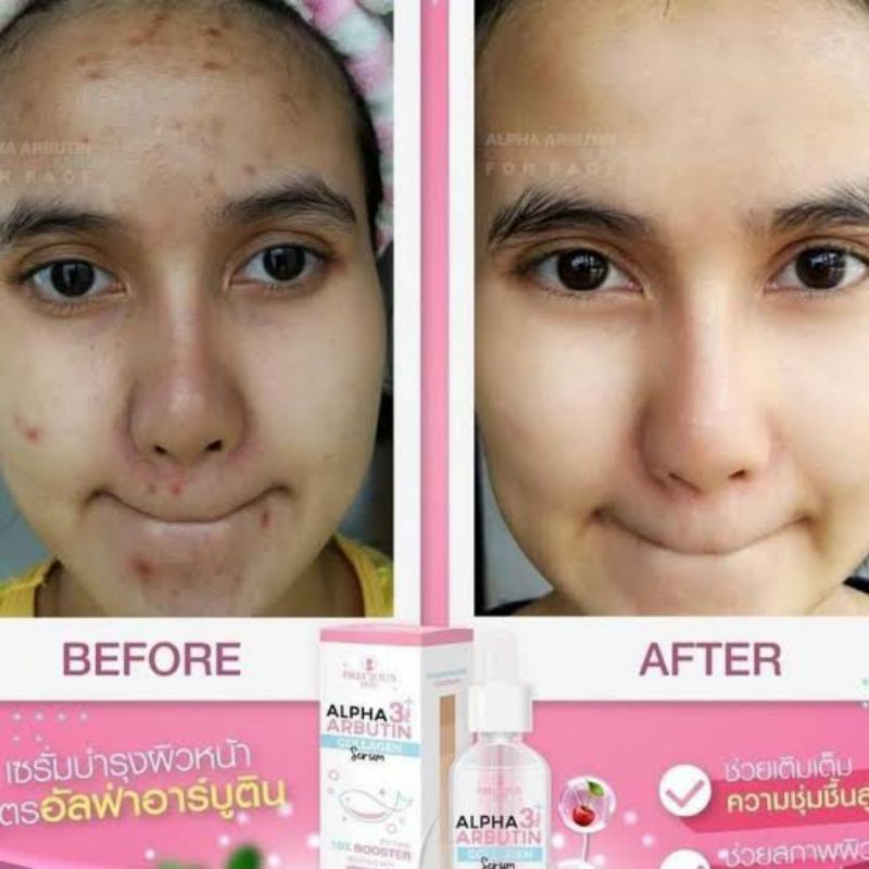 Serum Wajah Alpha Arbutin Collagen Facial Whitening Serum / ALPHA ARBUTIN 3 COLLAGEN SERUM