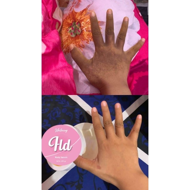 body serum HLD