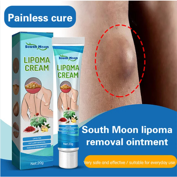 KRIM LIPOMA BENJOLAN LIPOMA OBAT  |  OBAT BENJOLAN OBAT  LIPOMA REMOVAL CREAM 20G