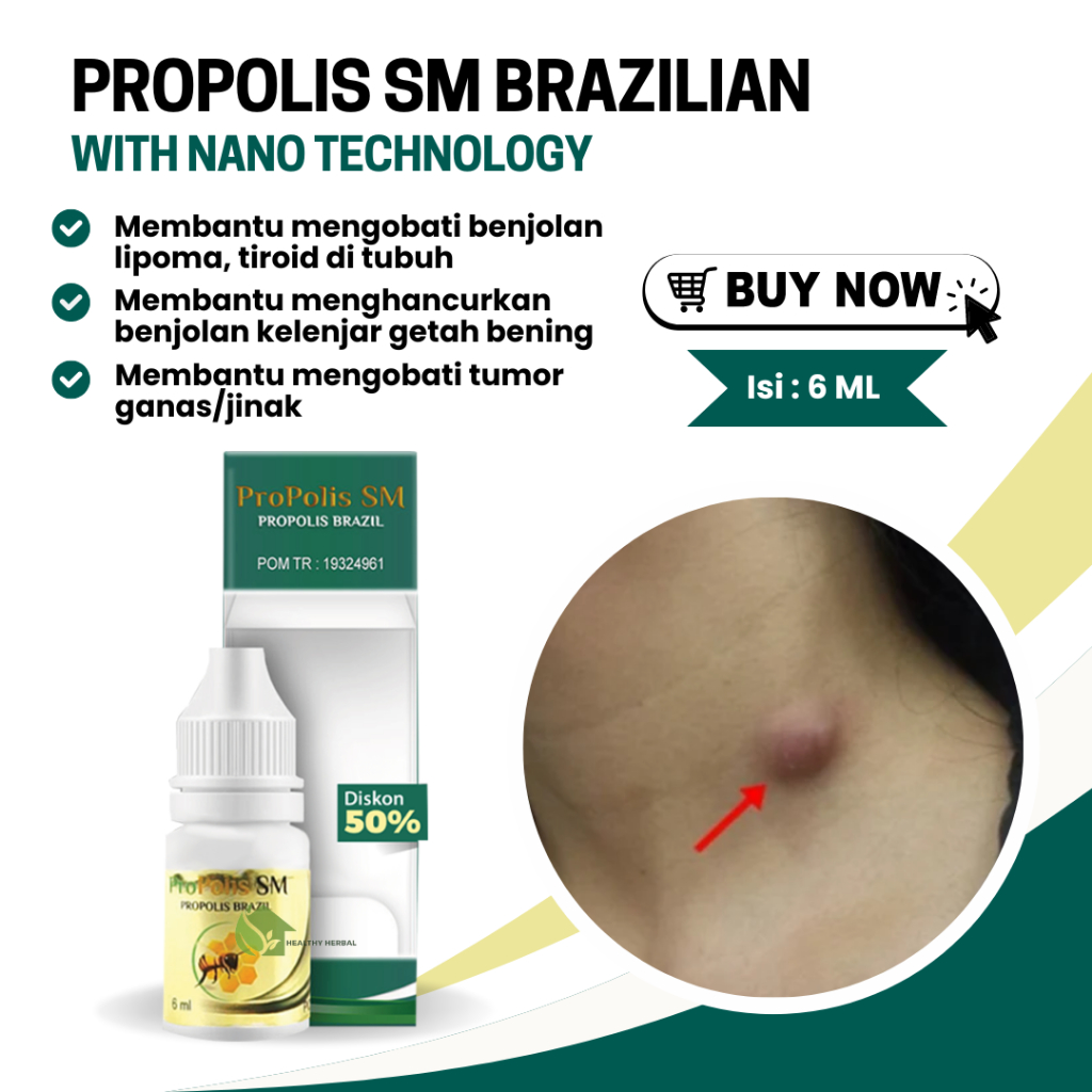 Obat Benjolan Lipoma Di Leher - Kepala - Ketiak - Paha - Propolis SM Brazil Original