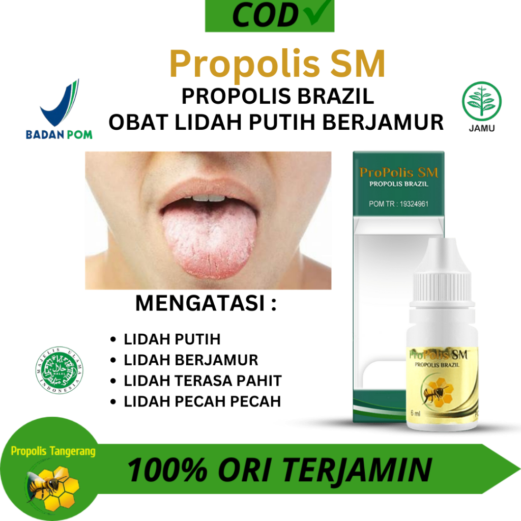 Obat Lidah Putih Berjamur,Obat Penghilang Bintik Putih Di Lidah,Obat Pembersih Lidah Berjamur