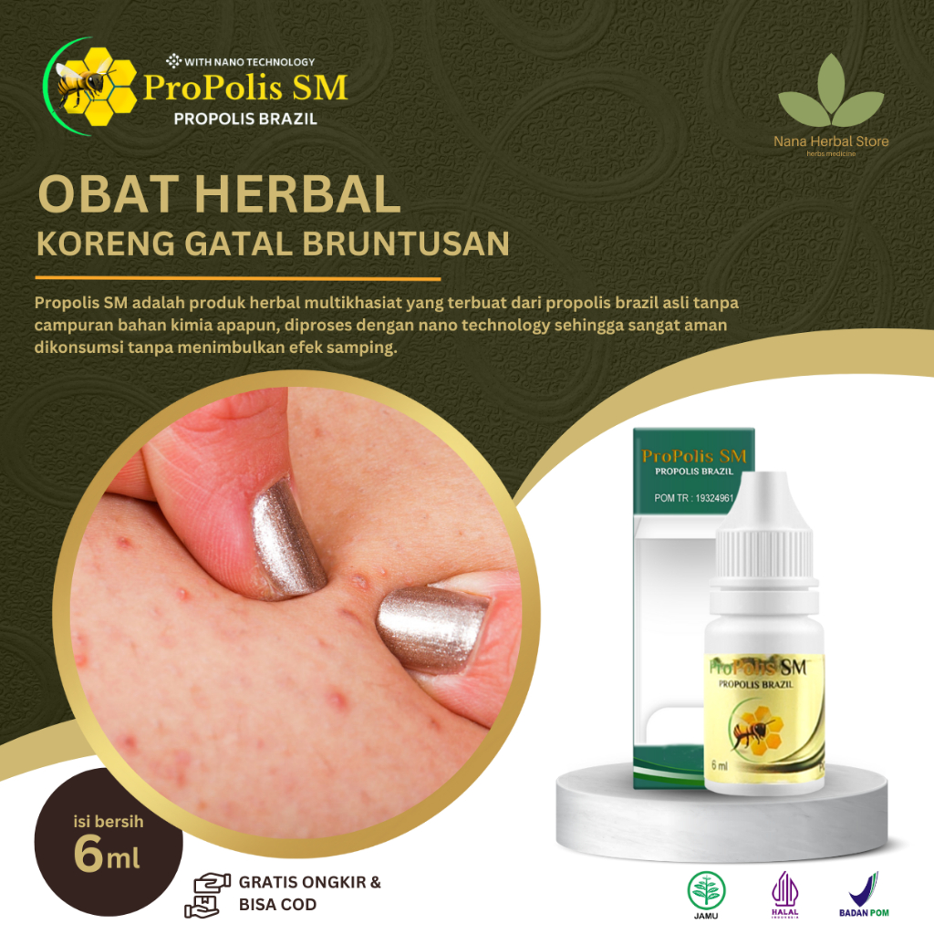 Propolis SM Brazil Salep Pantat Beruntusan, Obat Koreng Di Pantat, Obat Gatal Di Bokong, Obat Gatal 