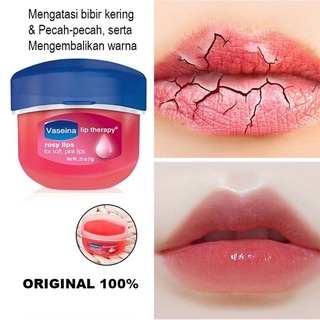 Vaseline Cream Pelembab Bibir Lip Rosy -Cream Obati Bibir kering Pecah - Pemerah Bibir Hitam