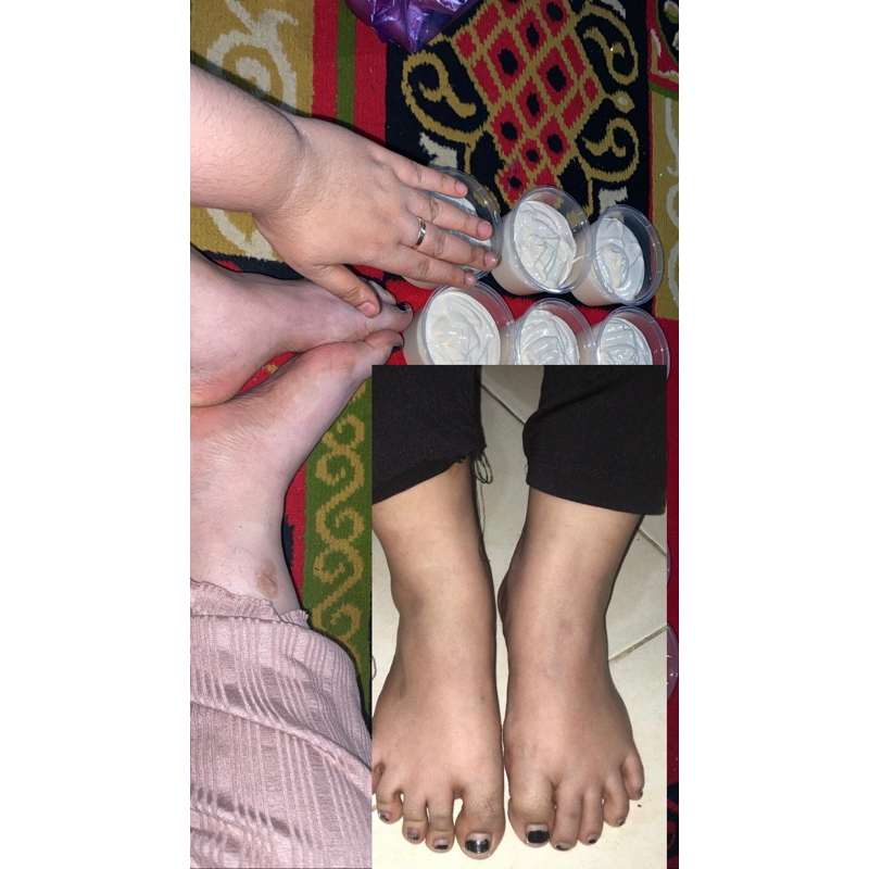 HB RACIKAN DOSTING PEMUTIH