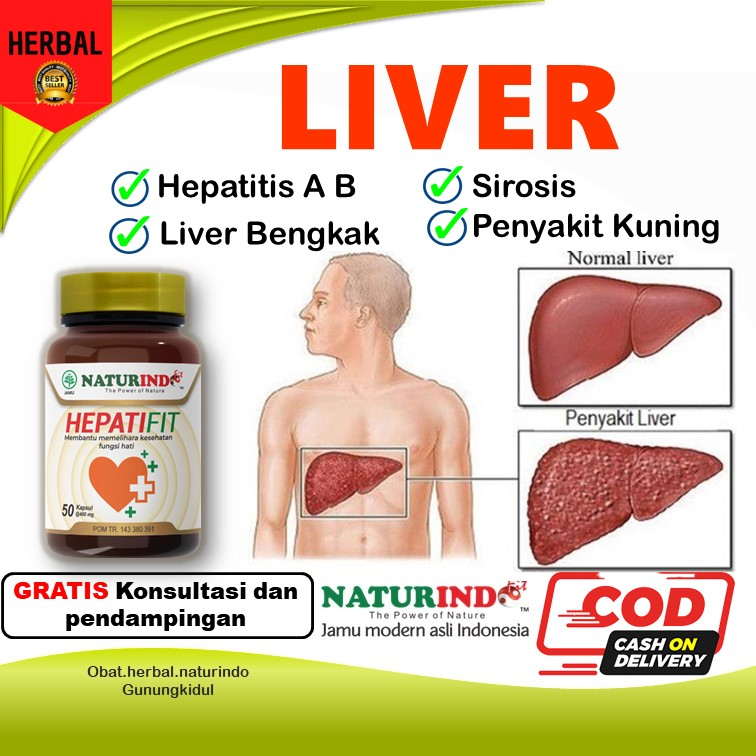 Obat Liver Perut Bengkak Hepatitis B Sirosis