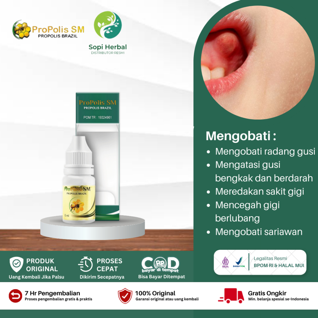 Obat Sakit Gigi Dan Gusi Bengkak, Obat Sakit Gusi Bengkak Bernanah, Gigi Berlubang, Obat Kumur Sakit