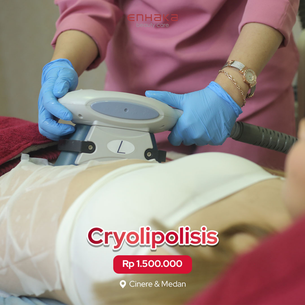 Cryolipolisis Enhaka Cinere dan Medan