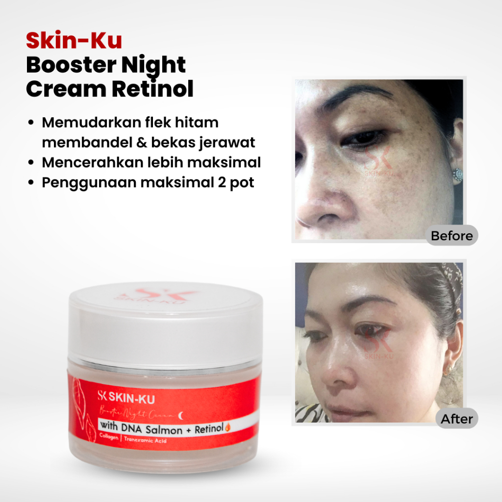 Night Cream Booster Retinol + DNA Salmon (BPOM) untuk flek hitam bandel