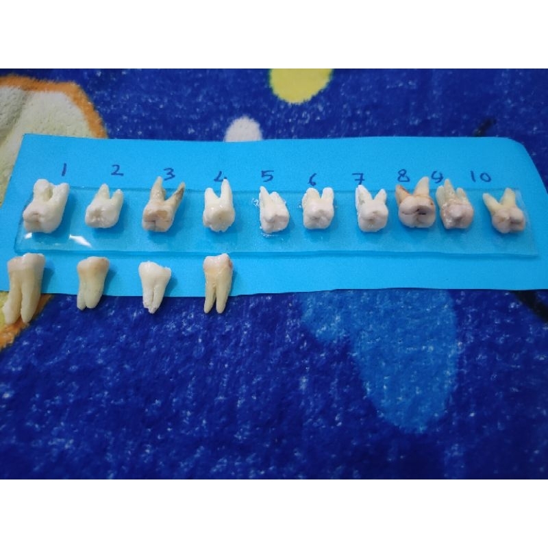 Gigi Molar Asli Praktikum Kedokteran Gigi