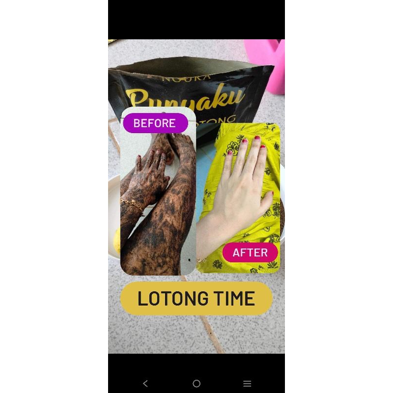 NOURA PUNYAKU BEDDA LOTONG