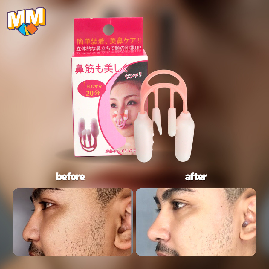 Nose Up Clipper Nose Up Shaper Shaping Clip Beauty Nose Up Lifting PEMANCUNG HIDUNG