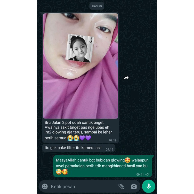 1000% Original Harga Reseller Cream Thailand As Pemutih Wajah Cream Jerawat Batu Dan Penuaan