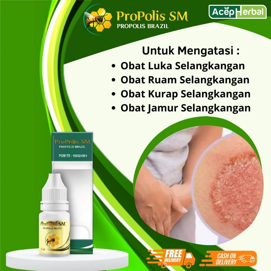 Obat Jamur Selangkangan, Kurap Selangkangan, Obat Selangkangan Hitam, Obat Gatal Selangkangan, Obat 
