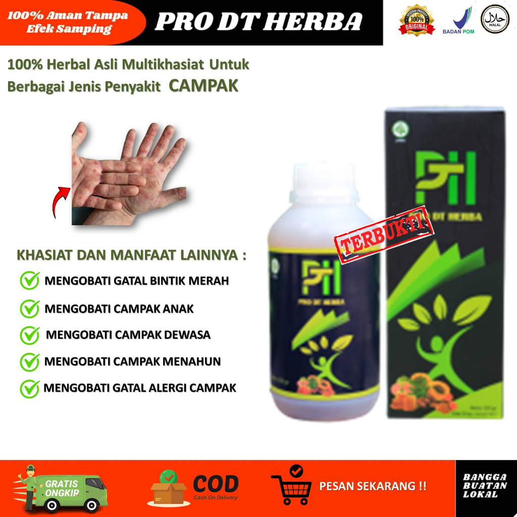 Obat campak mapoh penghilang bekas campak, herpes, cacar, anti radang dan iritasi untuk anak dewasa 