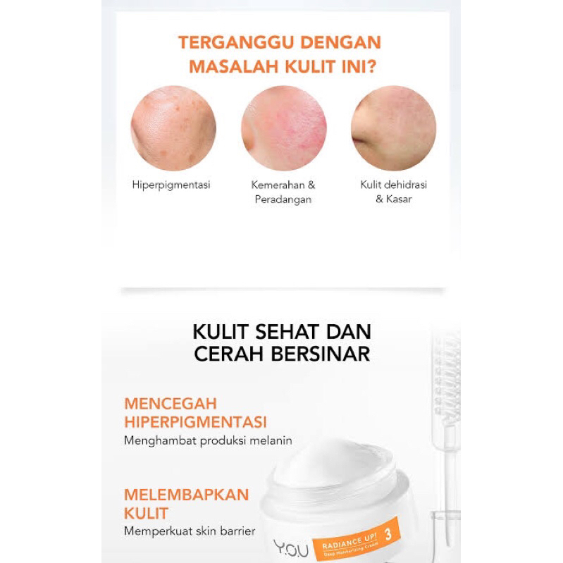 YOU radiance up moisturizing cream ( melembabkan, flek, bekas jerawat )