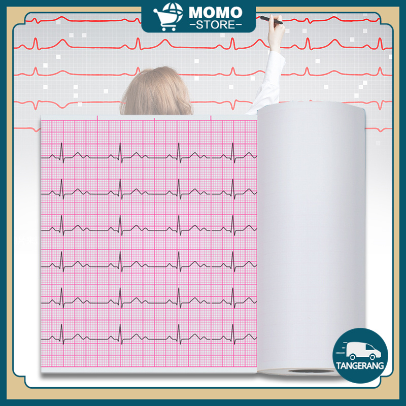 

Kertas EKG Roll 80mmx20m 110mmx20m 210mmx20m Kertas ECG Roll Untuk ECG