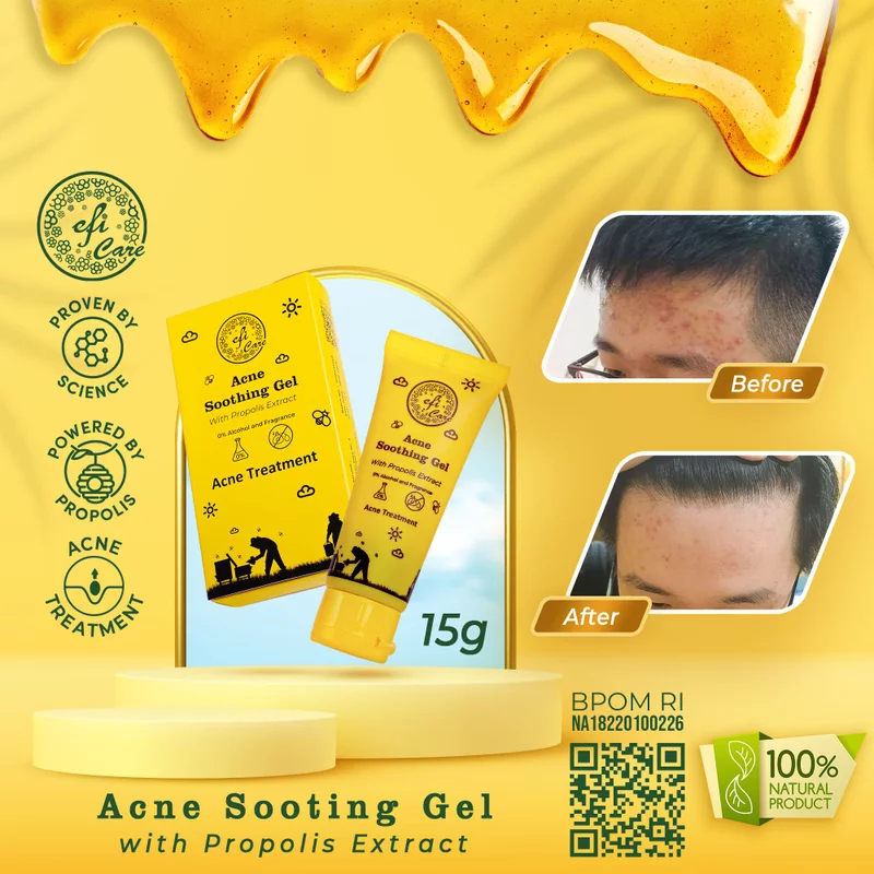 Efi Propolis Care Acne Treartment Soothing Gel Jerawat by Kebun Efi