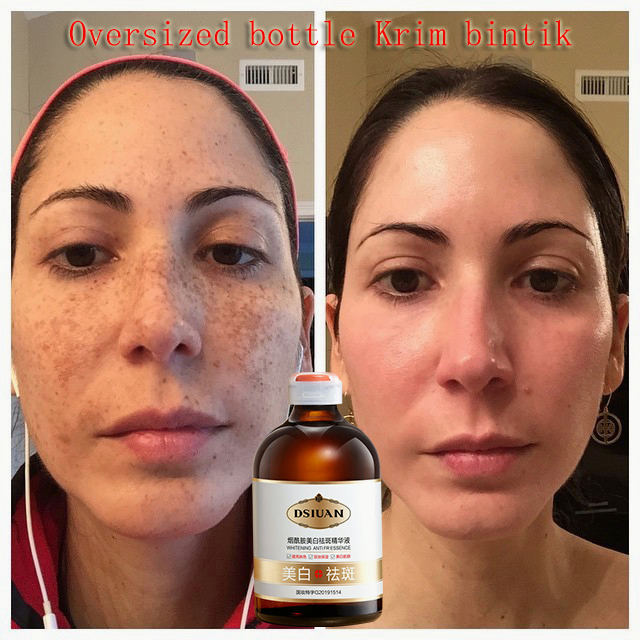 Pemutihan pghilang bintik wajah Serum penghilang bintik pemutih wajah Serum penghilang bintik hitam 