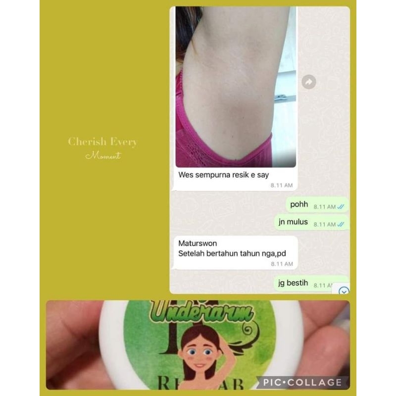 Magic Underarm Original Rhajab | Pemutih Lipatan CREAM LIPATAN PALING AMPUH