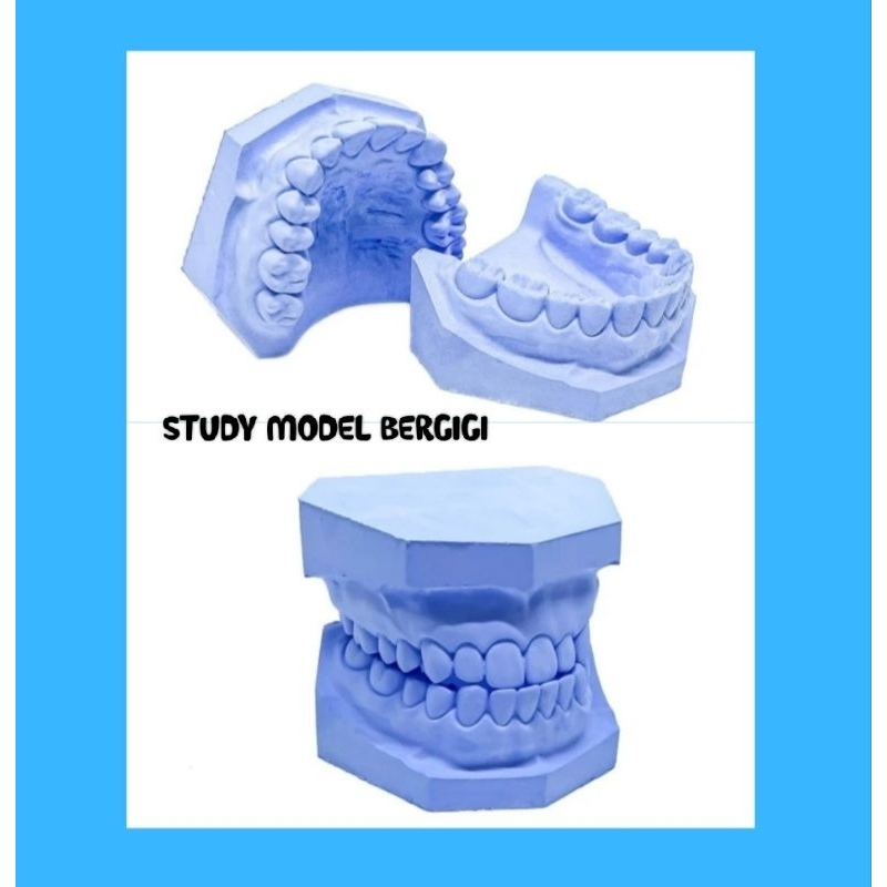 ~ AHHA ~ STUDY MODEL GIPS BERGIGI