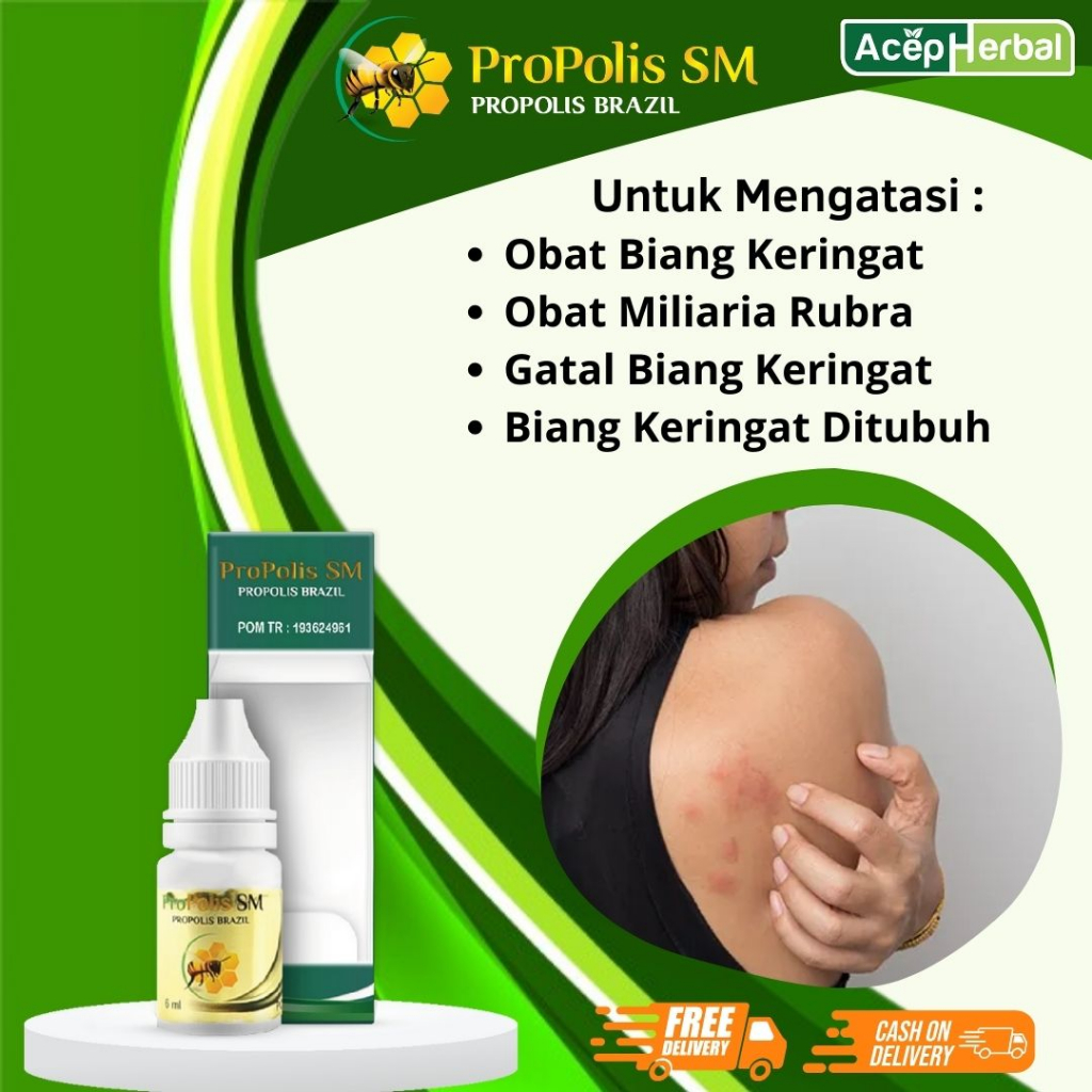 Obat Biang Keringat - Obat Miliaria Rubra, Obat Gatal Biang Keringat, Obat Biang Keringat Anak dan D