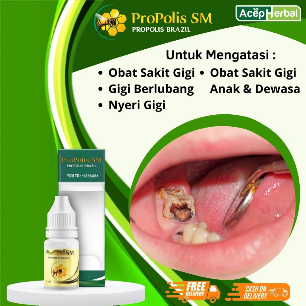 Obat Sakit Gigi Berlubang - Obat Sakit Gigi ,Obat Nyeri Gigi, Obat Sakit Gigi Anak Dan Dewasa PROPOL