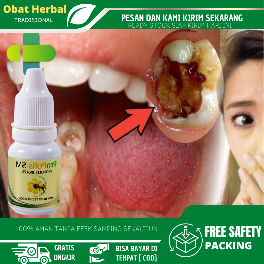 Obat Perontok Akar Gigi Berlubang,  Obat Penghilang Sisa Gigi Berlubang, Obat Gigi Berlubang Agar Ce