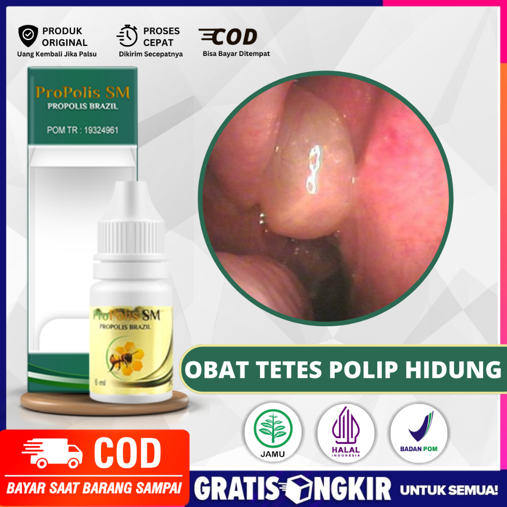 Obat Tetes Polip Hidung, Radang Sinusitis Sinusitis, Hidung Mampet, Tersumbat, Meler Propolis SM