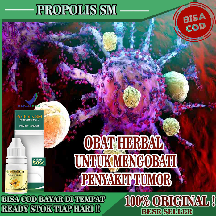 Obat Untuk Mengobati Penyakit Tumor, Obat Pencegah Sel Tumor Ganas, Obat Penyakit Tumor Jinak, Propo