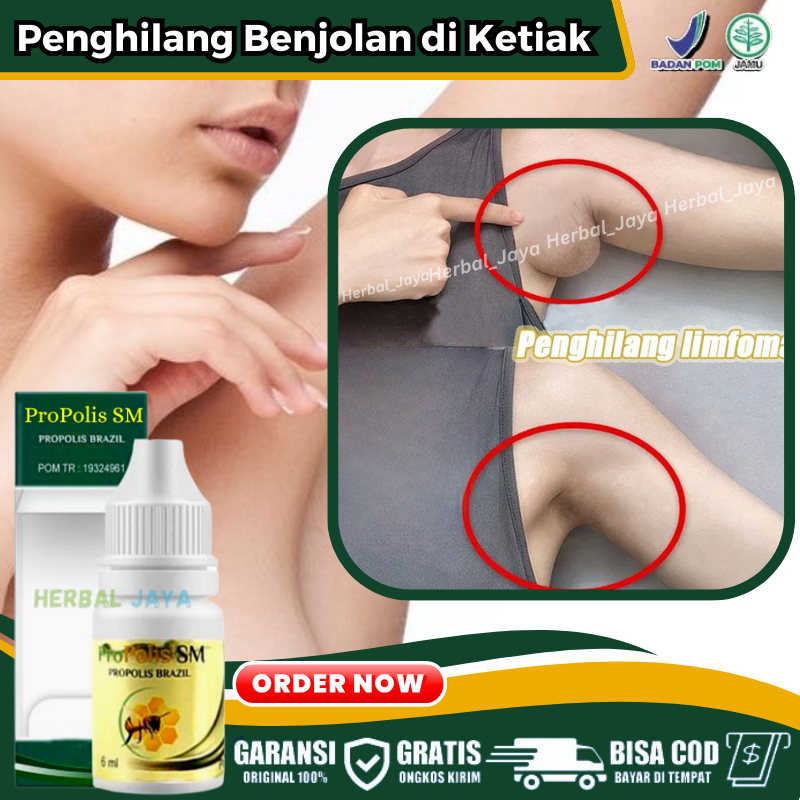 Obat Limfoma, Penghilang Benjolan Abnormal di Ketiak, Obat Limfoma / Kanker Kelenjar Getah Bening di