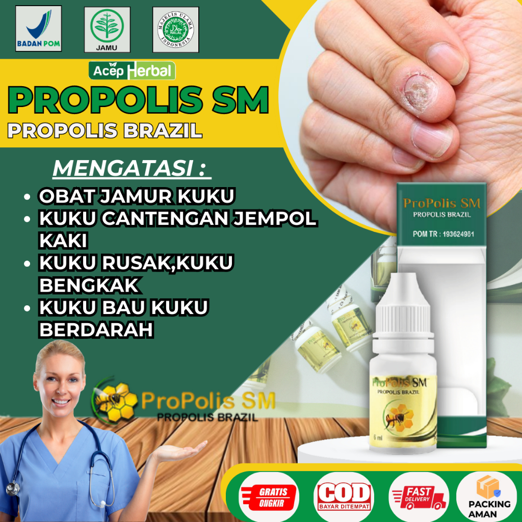 Obat Cantengan Infeksi Jamur kuku Infeksi Jamur kuku Kuku Rusak Kuku Bernanah Kuku Bengkak Kuku Bau 