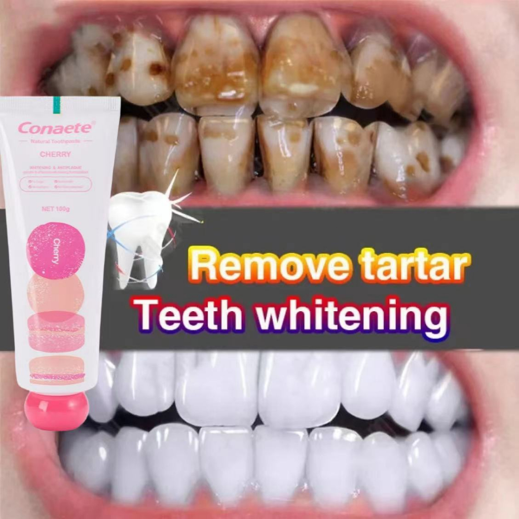Whitening toothpaste Gigi putih Pasta gigi whitening Pasta gigi pemutih gigi Odol pemutih gigi dan k