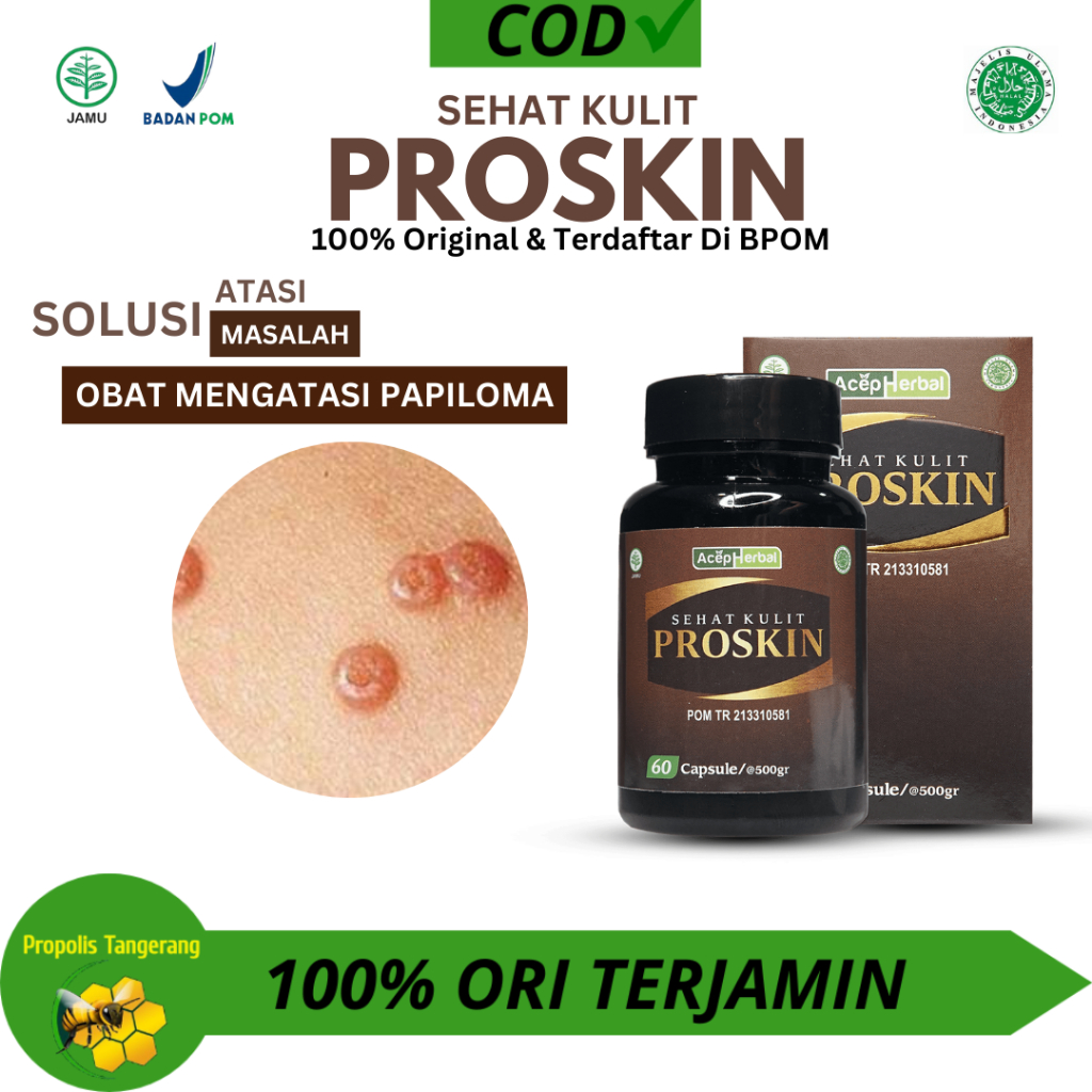 Obat Kulit Papiloma Obat Kutil Obat Kutil Kelamin Obat Gatal Gatal Seluruh Badan Obat Kulit Eksim Ob