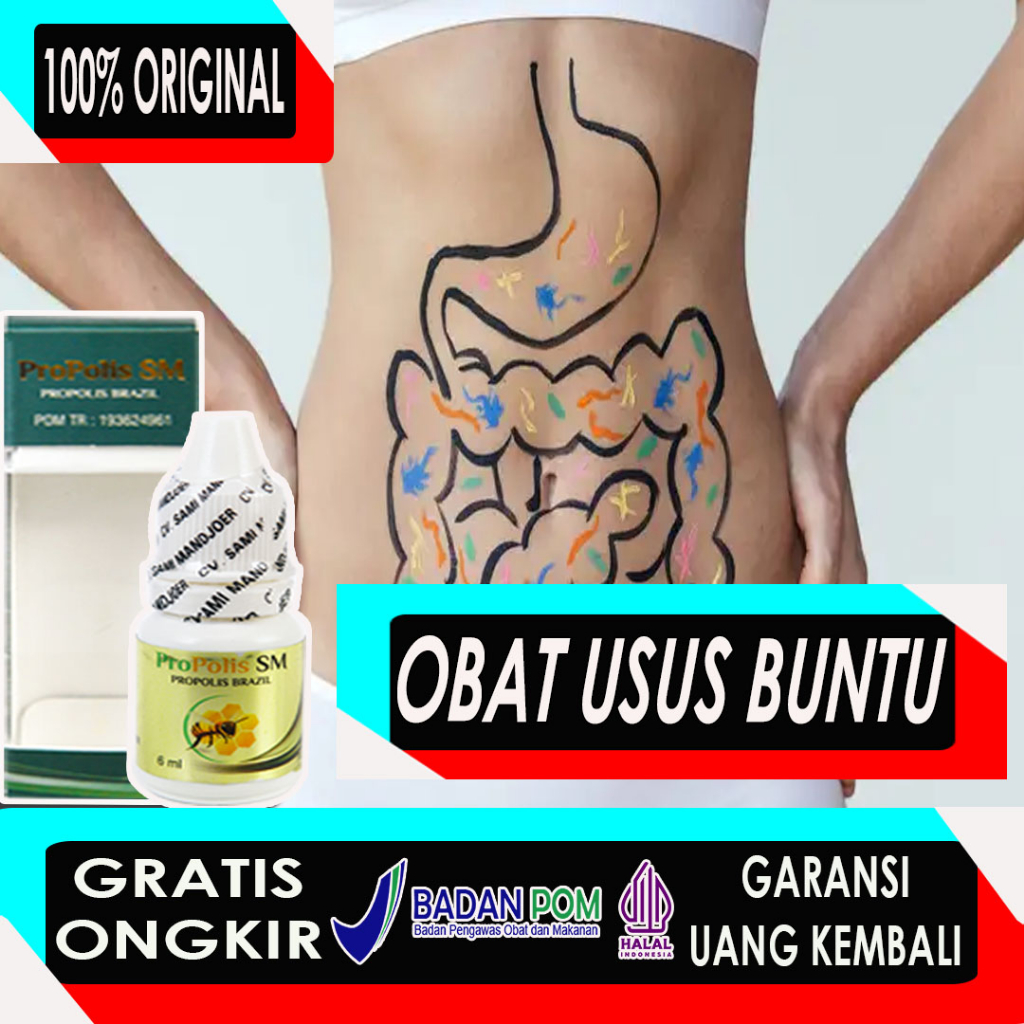 Propolis Sm - Obat Radang Usus Buntu Kronis - Kram Usus - Infeksi Usus Bermasalah - Asam Lambung