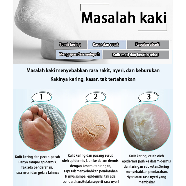 Original Pelembab dan Perawatan Retak Tumit dan cream kaki kapalan Cream kaki pecah Untuk Kulit Kering dan Pecah Perawatan Kulit kaki halus