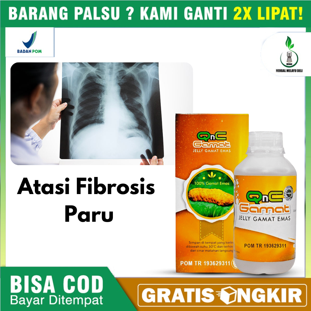 Mencegah  Fibrosis Paru , Sulit Bernafas , Sesak Nafas ,  Infeksi Paru Paru , Cairan Paru Paru , Fle
