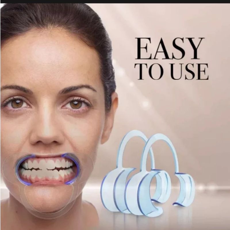 Alat Penyangga Pembuka Mulut Retractor Dental Praktek Dokter Gigi