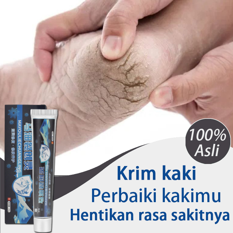 bp132- Krim kaki pecah dan kering salep kaki pecah dan kering ampuh perawatan kaki pecah dan kering