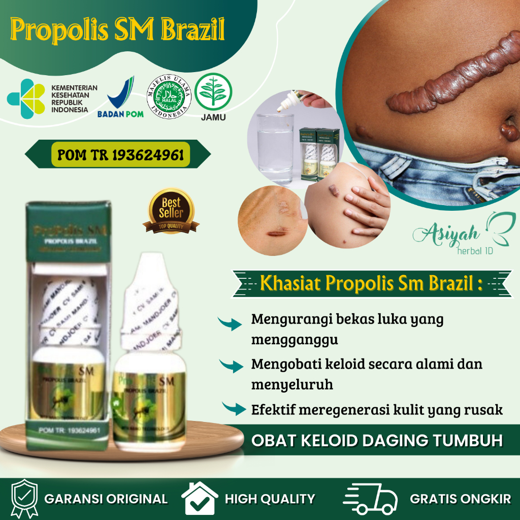 Obat Keloid Daging Tumbuh, Keloid Menonjol Tahunan, Penghilang Keloid Berkerut, Obat Keloid Bekas Op