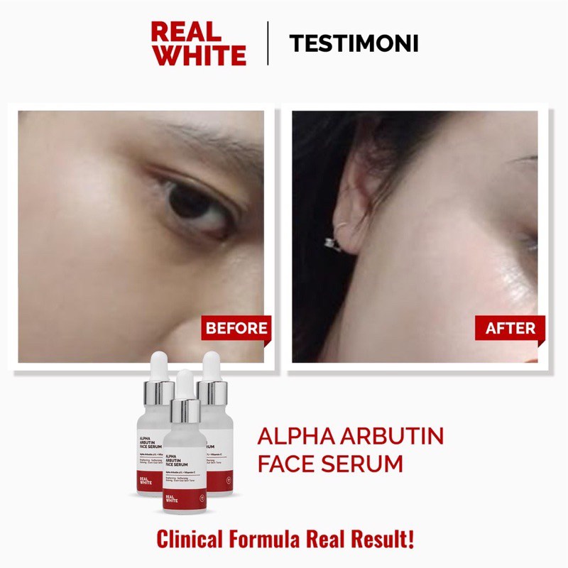 REAL WHITE Alpha Arbutin Serum real white BPOM face serum realwhite alpha arbutin