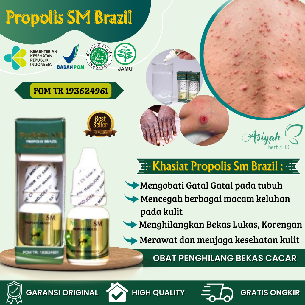 Obat Penghilang Bekas Cacar Air, Bekas Cacar Hitam, Bekas Cacar Berlubang, Bopeng Bekas Cacar Atasi 