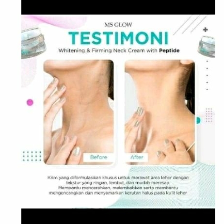 Krim leher ms glow /neck cream ms glow kulit hitam
