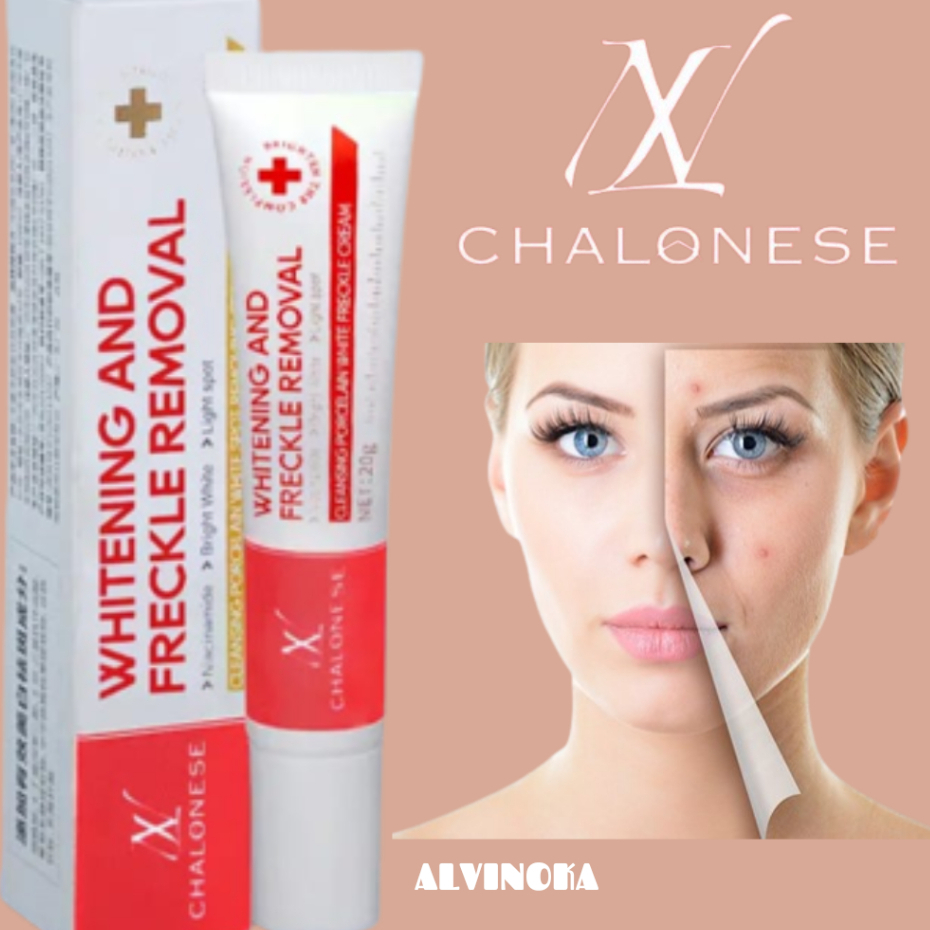 CHALONESE cream WHITENING AND FRECKLE REMOVAL MENGHILANGKAN BEKAS JERAWAT 20G