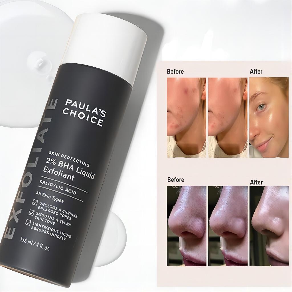 PAULA'S Skin Perfecting 2% BHA Liquid Exfoliant 118ML/Paulas Choice 2% Bha/Paula S Choice 2% Bha/Sal