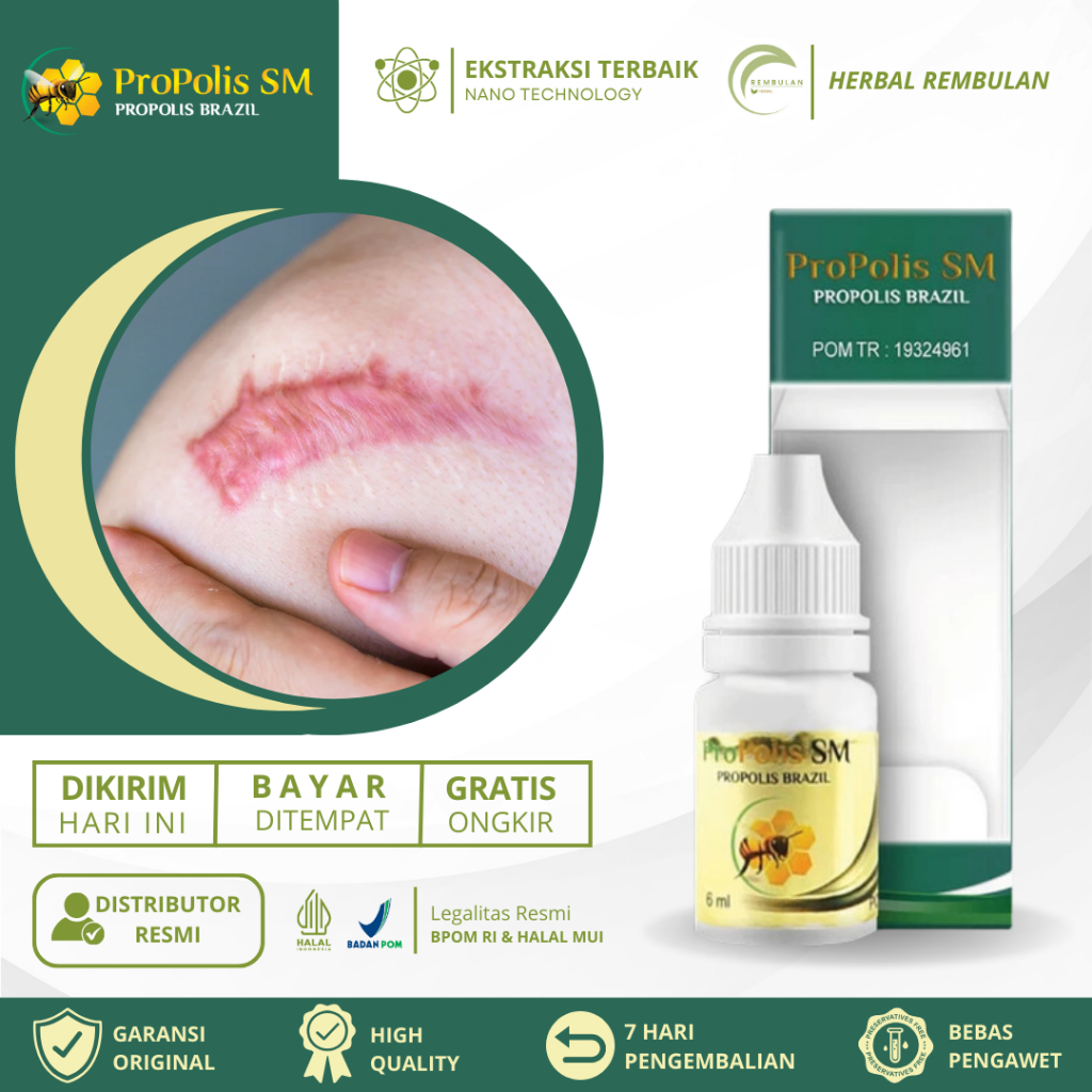 Obat Keloid, Obat Penghilang Keloid, Obat keloid Luka tindik, Obat keloid Daging Tumbuh, Obat Keloid